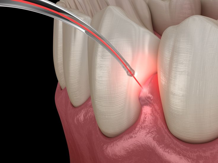 Procedure Image