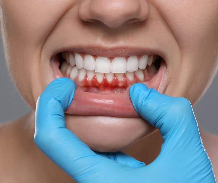 Procedure Image