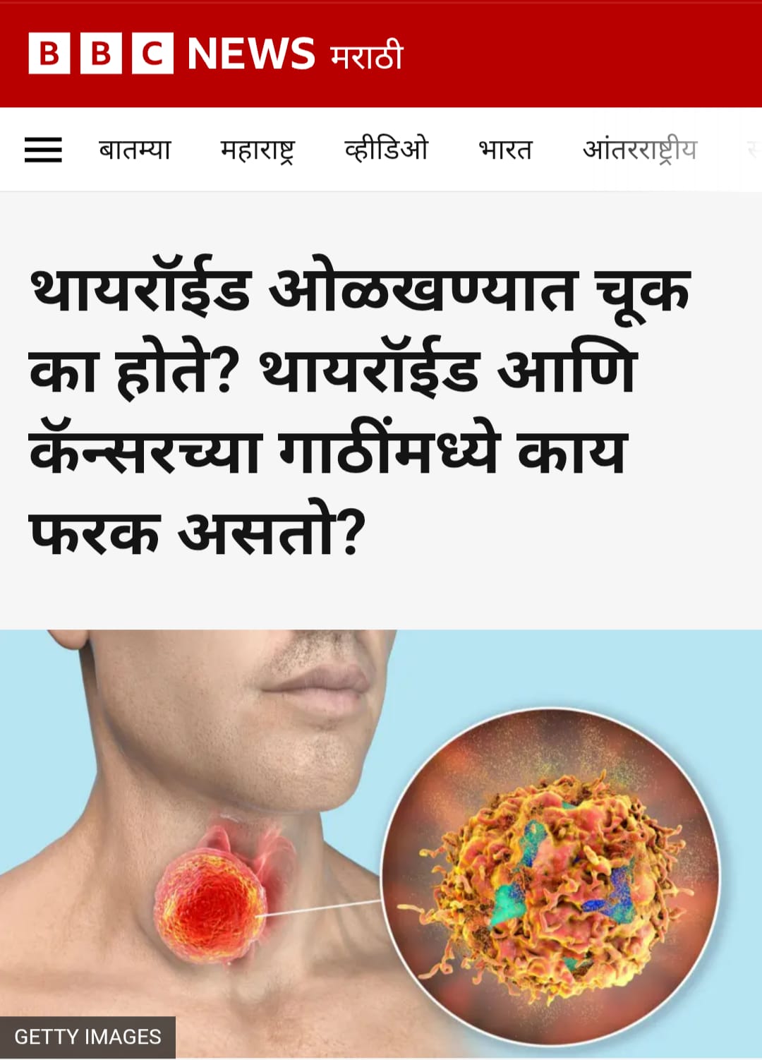 थायरॉईडच्या सगळ्या आजारांवर आयोडिन मीठ हेच औषध?