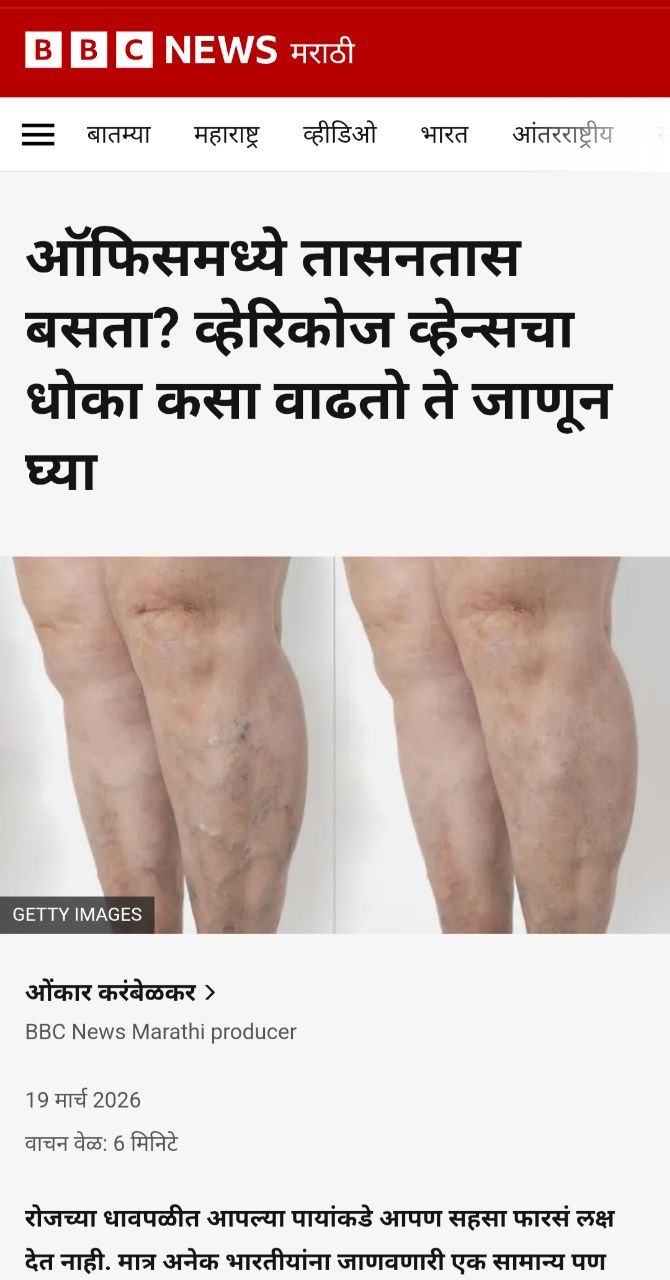 ऑफिसमध्ये तासनतास बसता? व्हेरिकोज व्हेन्सचा धोका कसा वाढतो ते जाणून घ्या